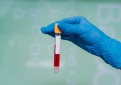 Kupiškis tarp didelės rizikos savivaldybių pagal epidemiologinį rodiklį